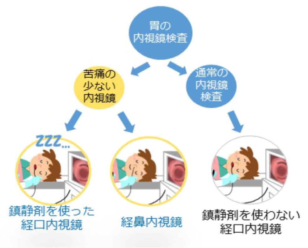 苦痛の少ない内視鏡検査