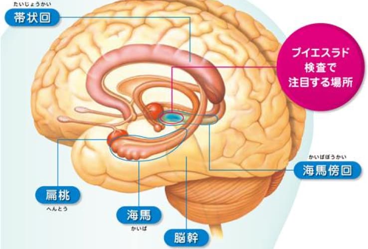 脳内の図