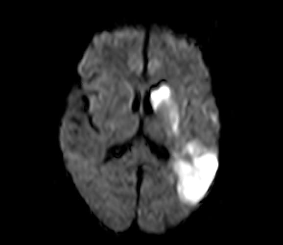 頭部のMRI1