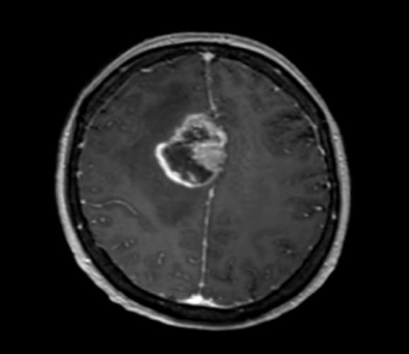 頭部のMRI2