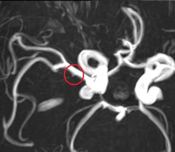 頭部のMRI3