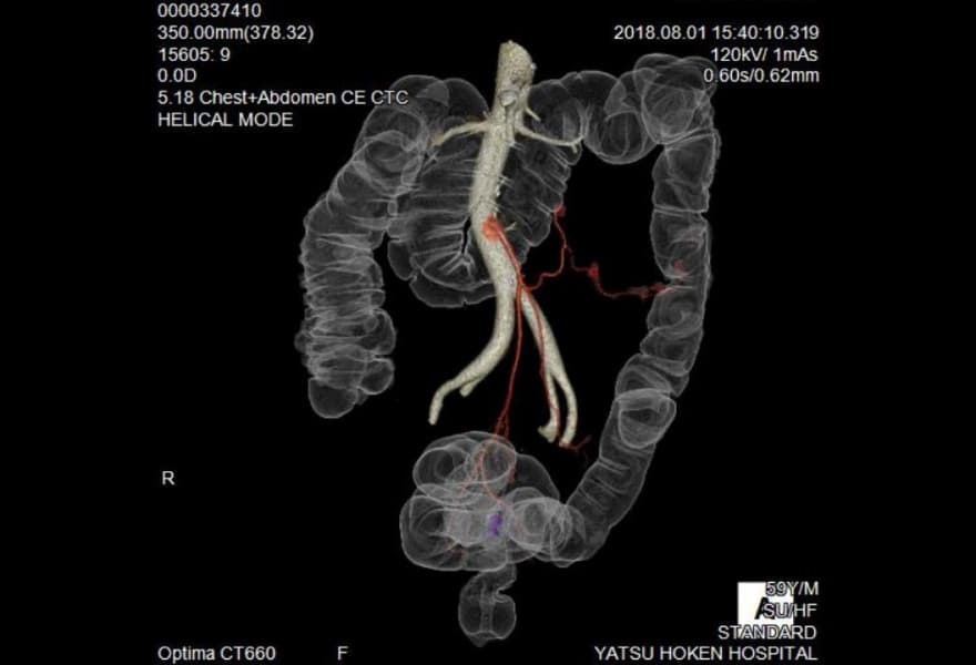 3D-CT