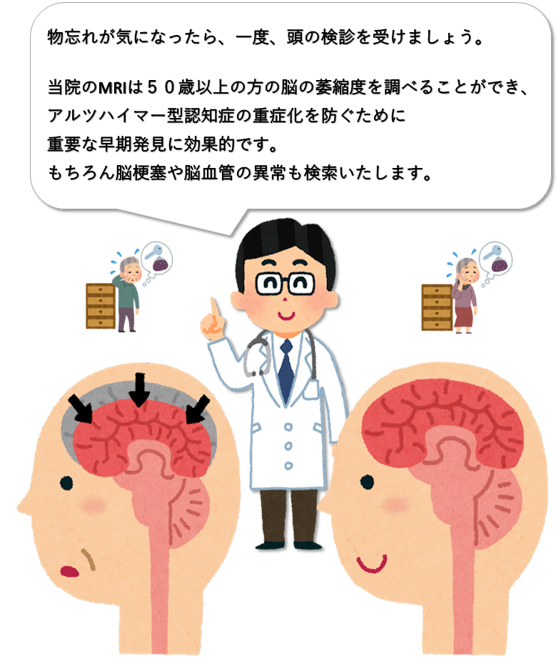 頭部MRI検診